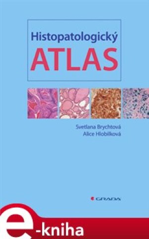 Product detail of Histopatologický atlas - Svetlana Brychtová, Alice Hlobilková