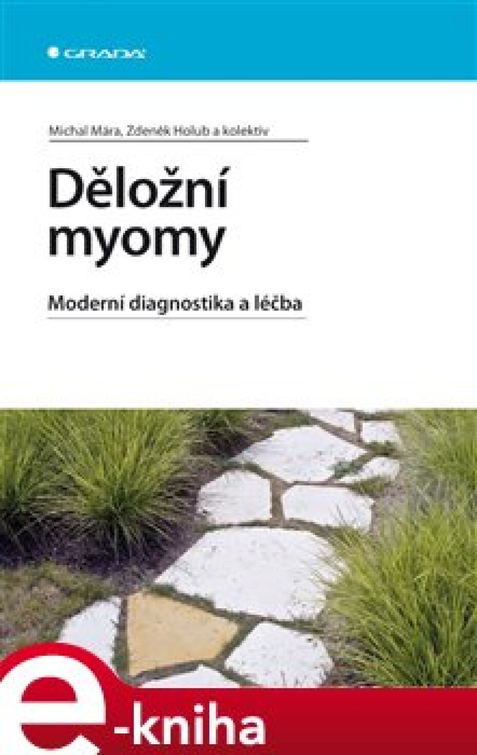Děložní myomy - Michal Mára, Zdeněk Holub - main (0)